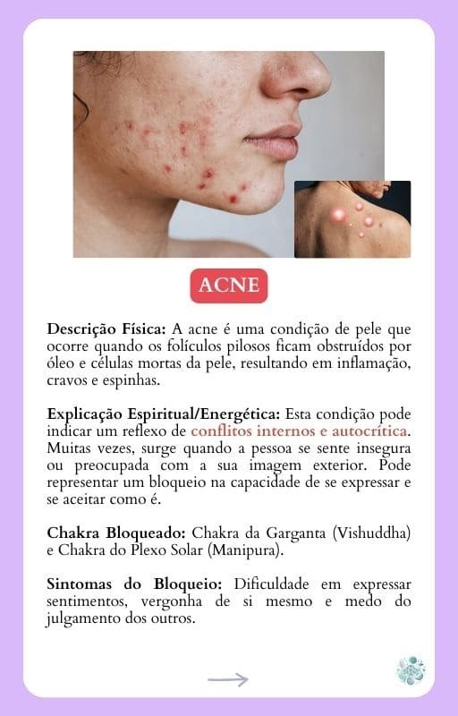 Ficha do conteúdo: Acne, explicação espiritual, chakra envolvido e receita